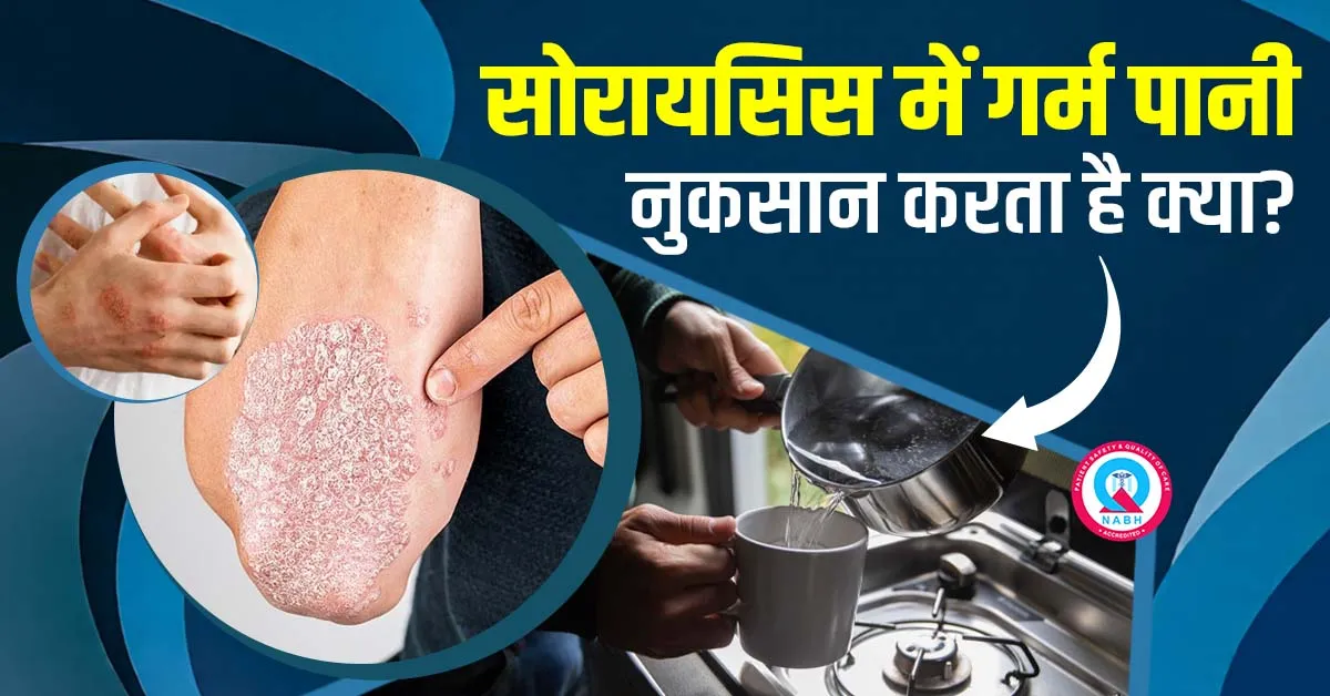 सोरायसिस में गर्म पानी नुकसान करता है क्या?